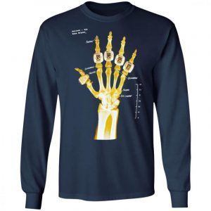 Kobe Bryant hand gold rings x-ray 2