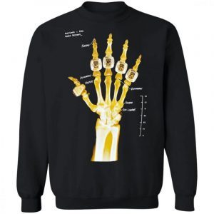 Kobe Bryant hand gold rings x-ray 4