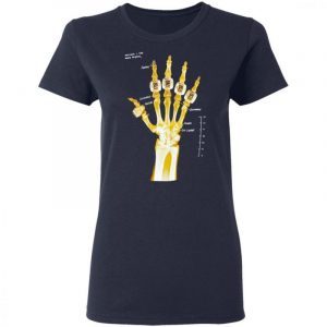 Kobe 5 Rings Hand X-Ray Shirt 1